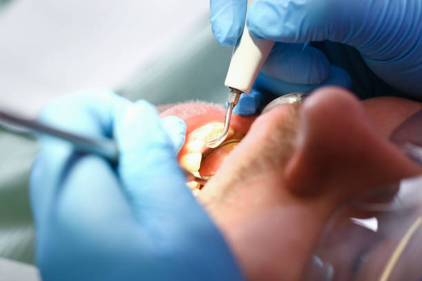 Best Emergency Cosmetic Dentistry (e.g., broken veneers) in Winooski, VT