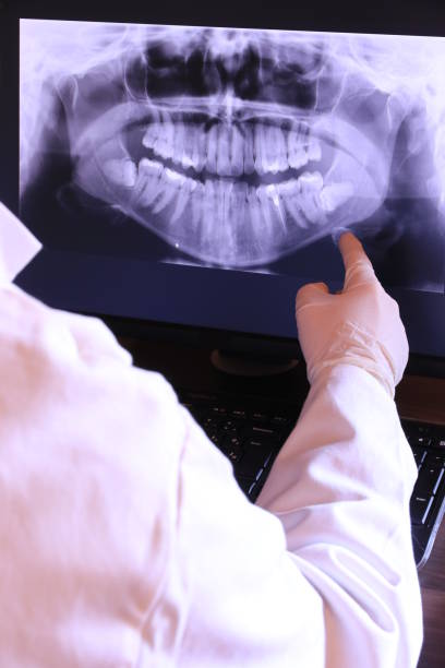 Best Emergency Wisdom Tooth Extraction in Winooski, VT